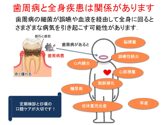 歯周病と全身疾患